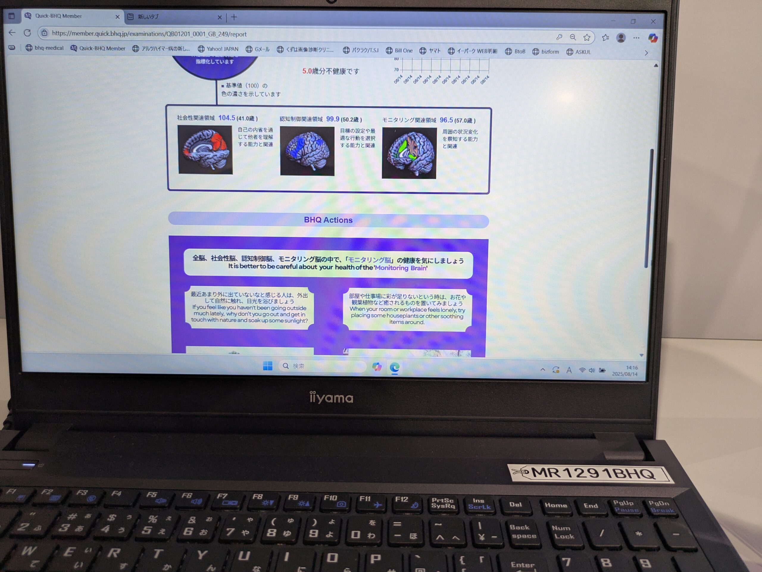 大学ブースの脳年齢モニタリング結果画面